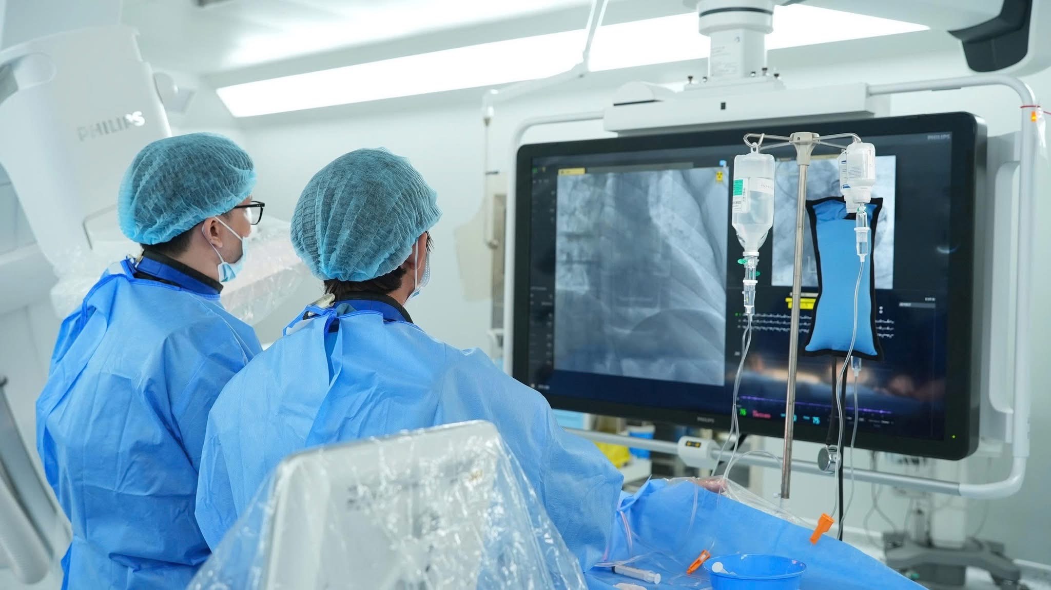 Cath Lab (DSA) Là Gì?