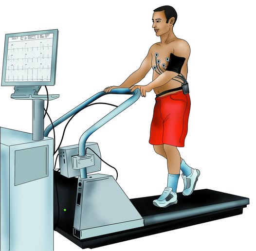 Máy Chụp Cắt Lớp Vi Tính Động Mạch Vành (CT Scan Động Mạch Vành)