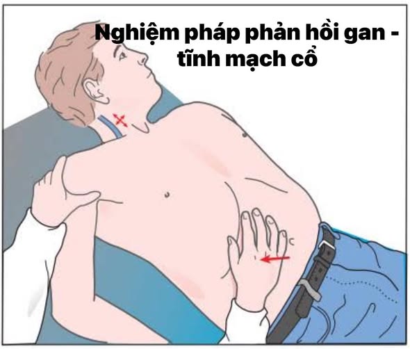 Tĩnh mạch cảnh là gì?